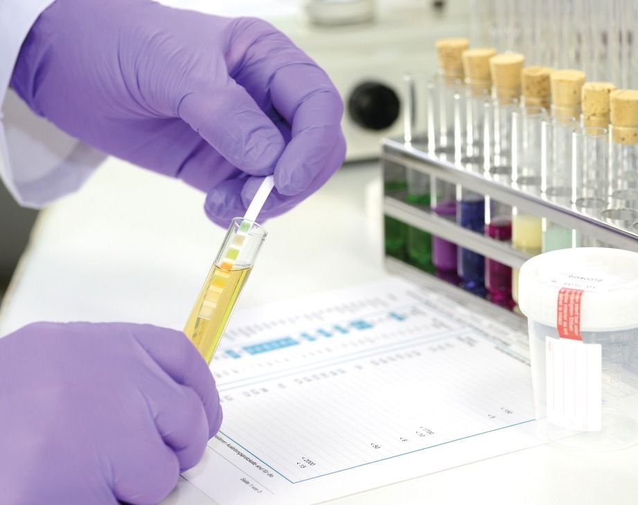 Everything employers need to know about hair drug testing for safe and productive workplaces